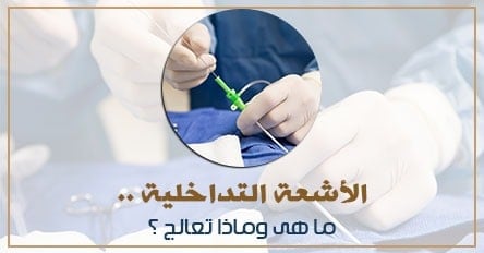الأشعة التداخلية …… مستقبل علاج الأمراض في مصر المقبلة